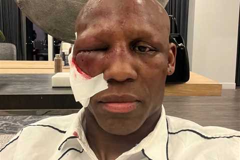 Yordenis Ugas shares gruesome update of horror injury and reveals he couldn’t open swollen right..