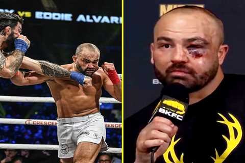 Conor McGregor’s UFC rival Eddie Alvarez shows off gruesome eye injury after bare-knuckle defeat..