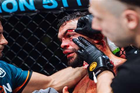 MMA Star Ivan Buchinger Left Needing 35 Stitches After Horror Facial Injuries