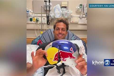 World champion surfer Kai Lenny holding his cracked helmet ''It may have saved my life''